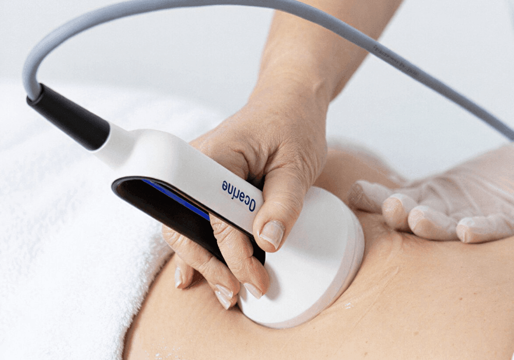 A close-up of a professional aesthetician's hand, with neatly manicured nails, applying a white handheld Ocarine device to a client's bare abdomen during a body treatment; the device features a sleek ergonomic design with a black grip, a curved gray cord, and the brand name 'Ocarine' printed in blue on its side, while the client’s skin appears smooth and slightly glistening, suggesting the use of a conductive gel, and a white towel is partially visible in the background, reinforcing a clinical or spa setting.